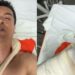 Cantor Regis Danese teve órgão perfurado em acidente e passa por cirurgia de emergência