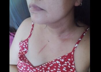 Homem é preso em flagrante suspeito de agredir irmã vereadora