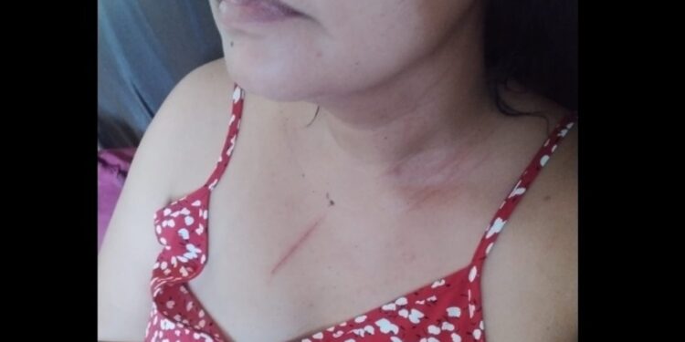 Homem é preso em flagrante suspeito de agredir irmã vereadora