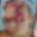 Mulher tem rosto desfigurado com agressões brutais do marido em Bodoquena