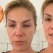 Advogado de Campo Grande consegue 1ª derrota de Ana Hickmann em processo contra o ex-marido
