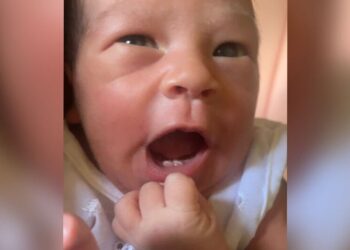 Bebê nasce com dois dentinhos e surpreende médicos em Campo Grande
