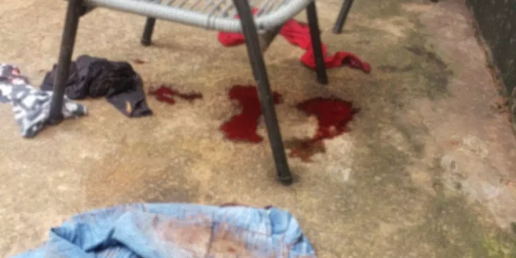 Filha dá facada na própria mãe após ser atingida por óleo quente no Tijuca em Campo Grande