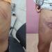 Menino autista é surrado dentro e fora da escola e Conselho Tutelar denuncia omissão  em Campo Grande