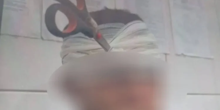 Jovem fica com tesoura cravada no rosto durante ‘brincadeira’ de casal