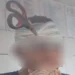 Jovem fica com tesoura cravada no rosto durante ‘brincadeira’ de casal